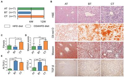 Sheng-Jiang powder ameliorates NAFLD via regulating intestinal microbiota in mice